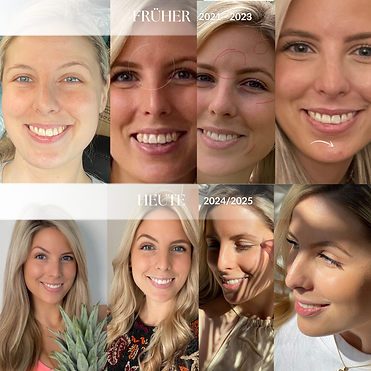 Vorher Nachher Bilder von Lisa May