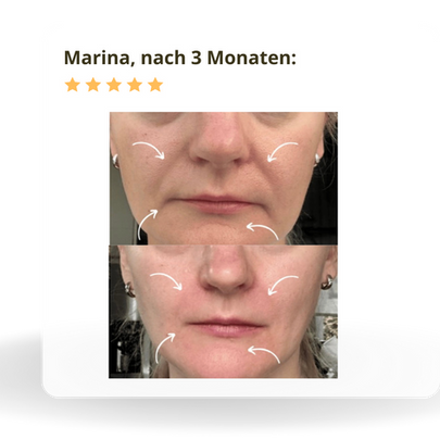 Vorher Nachher Bild Kundin