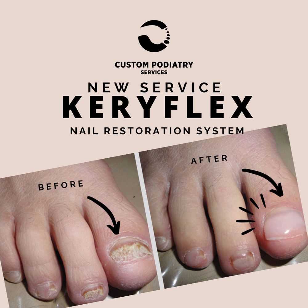 KeryFlex- Nail Restoration System