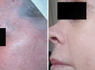 before-and-after.jpg.webp
