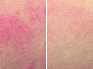 skin-brightness-before-after.jpg.webp