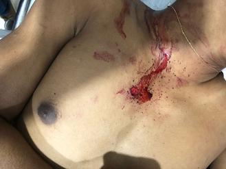 JOVEM DE 17 ANOS DISPAROU CONTRA POLÍCIA MILITAR USANDO UM REVÓLVER CALIBRE 38 E ACABOU SENDO MORTO