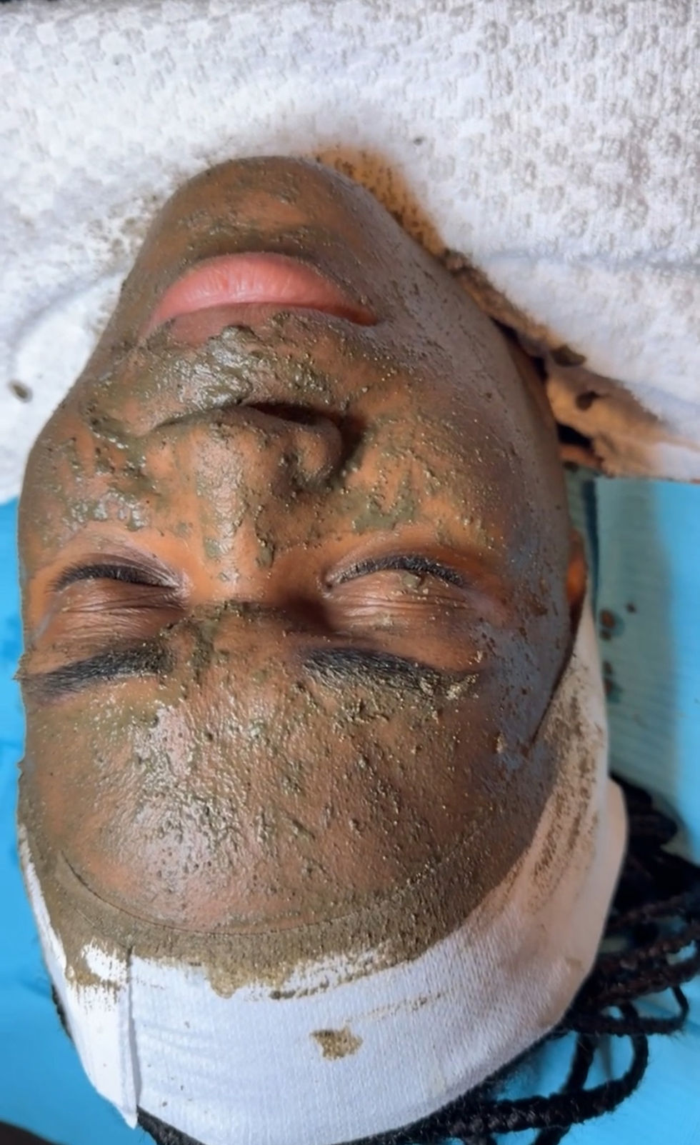zena algae peel for melasma