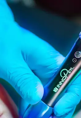 MICRONEEDLING LONDON,ON