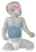 Ventriculoperitoneal Shunt