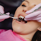 Root Canal dental treatment