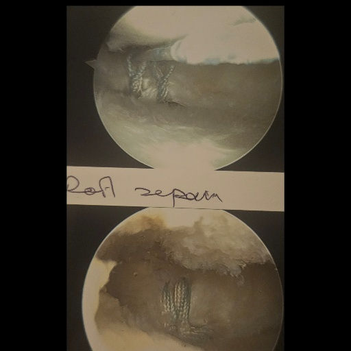 Thumbnail: Navigating Knee Surgery