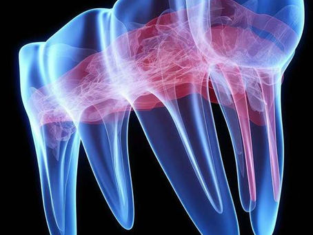 Neuromuscular Dentist in Dubai