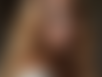 How to Choose the Right Wig for Alopecia in London