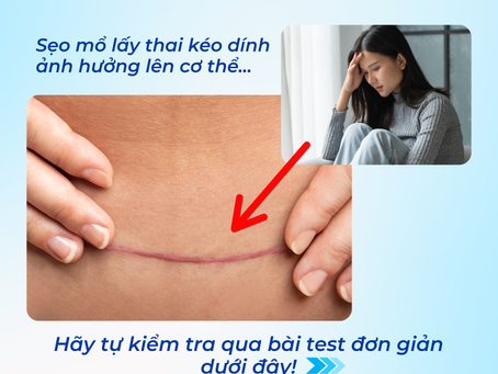 Sẹo mổ lấy thai kéo dính - ảnh hưởng đến đau lưng, tiểu tiện và năng lượng hằng ngày