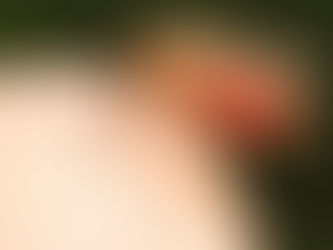 Salud interviene comunidades de Islas de la Bahía y Gracias a Dios Por casos de Malaria