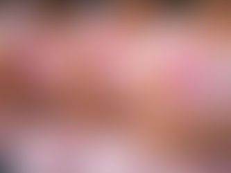 INICIATIVA PARA RECONSTRUCCIÓN DE SENO GRATUITA  ENTRA AL CONGRESO NACIONAL 