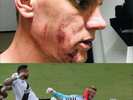 Criminal patada en el rostro: el arquero sufrió una grave lesión