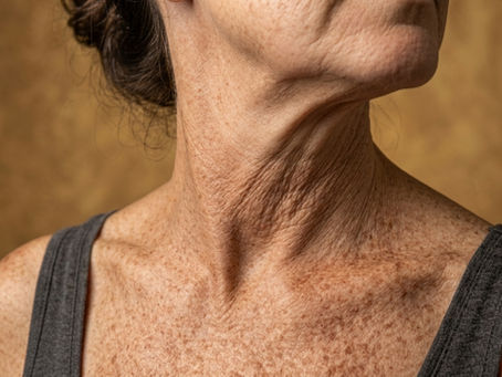 crepey skin can be improved with microchanneling treatments