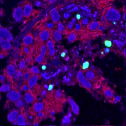 Composite (RGB)_liver_HM2_denoised.tif