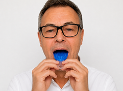 Zahnprothese online anfertigen lassen - Zahnprothesen online kaufen - Zahnprothese oberkiefer