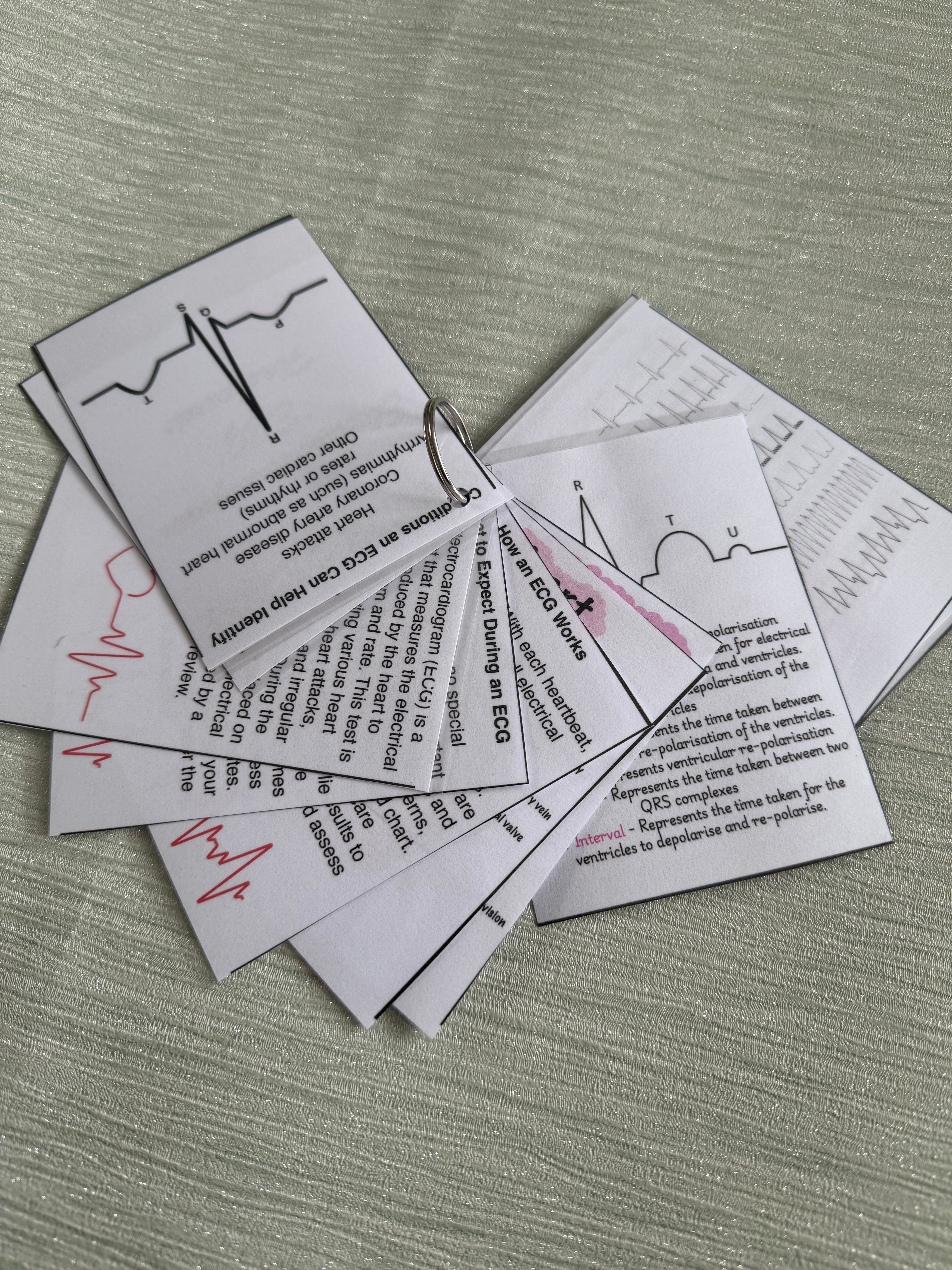 ECG Electrocardiogram Flashcards