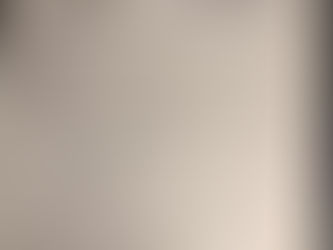 第67篇  黄芪桂枝五物汤加减显著改善严重荨麻疹一例