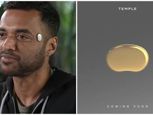 What is Zomato's CEO wearing on this forehead? 