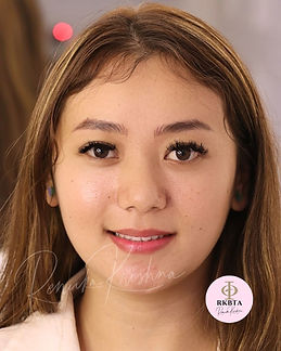 Combination Eyebrows, Microblading and Micropigmentation for client with no eyebrow, alopecia What Does Microblading Cost and Why Does Price Vary So Much? Renuka Krishna Nanoblading, Delhi India