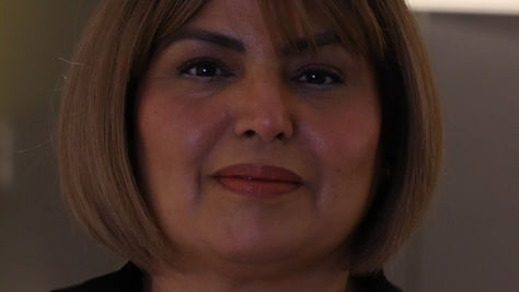 Lash Lift Treatment Explained in Detail: Process, Science, Safety, Longevity, and Who It Is Truly For, Delhi India