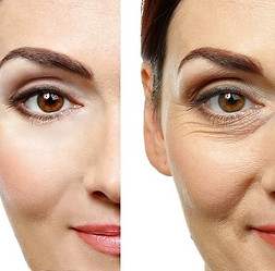 Anti-Aging-Spa-before-and-after-2_edited