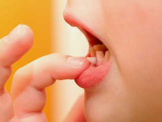 Meu filho caiu e quebrou um dente... o que fazer?