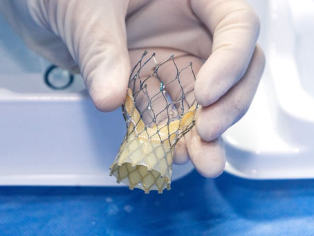 Huila, líder en tratamiento cardíaco sin cirugía de la mano de Clínica Medilaser