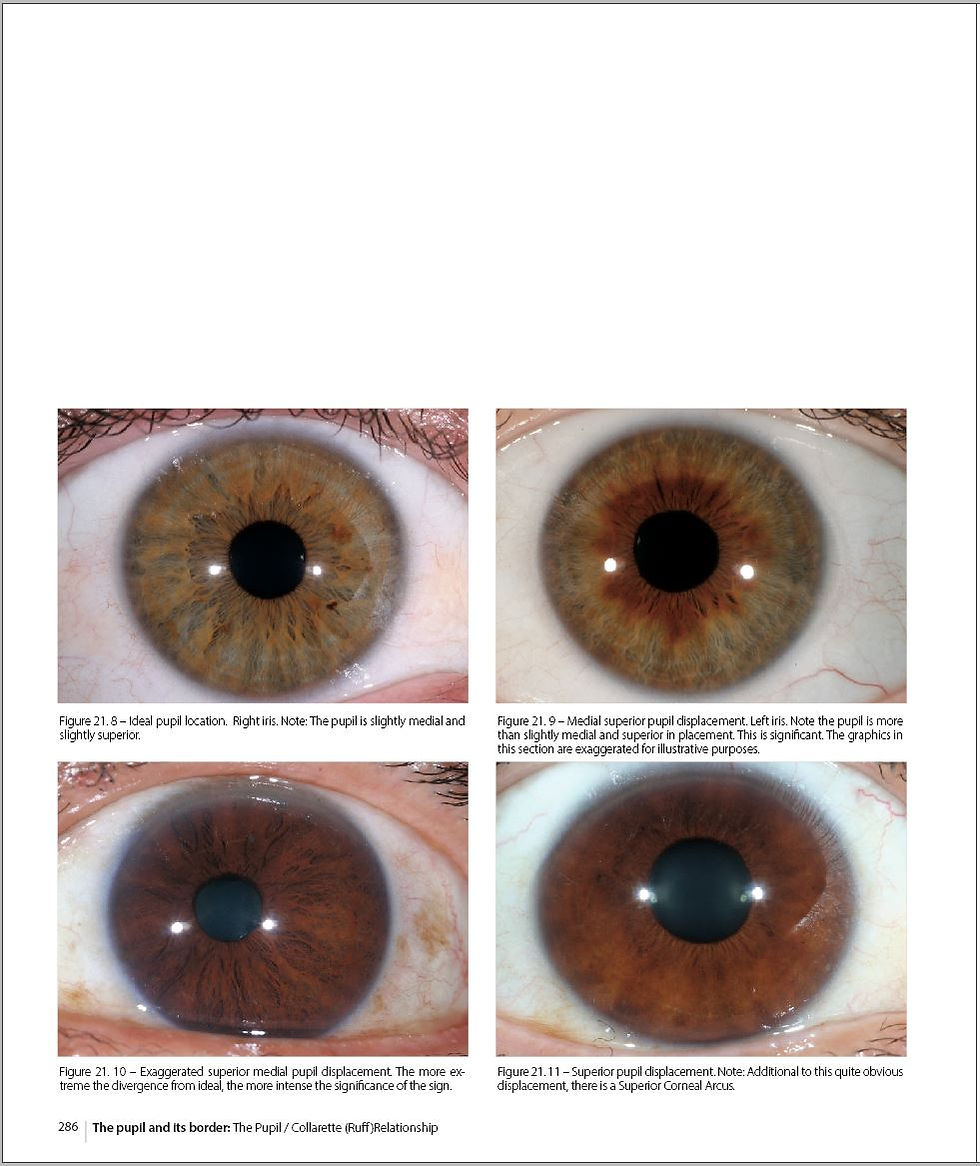 Thumbnail: Integrated Iridology textbook. Slightly damaged.