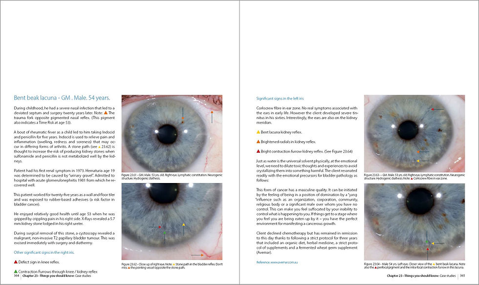 Thumbnail: Integrated Iridology Textbook