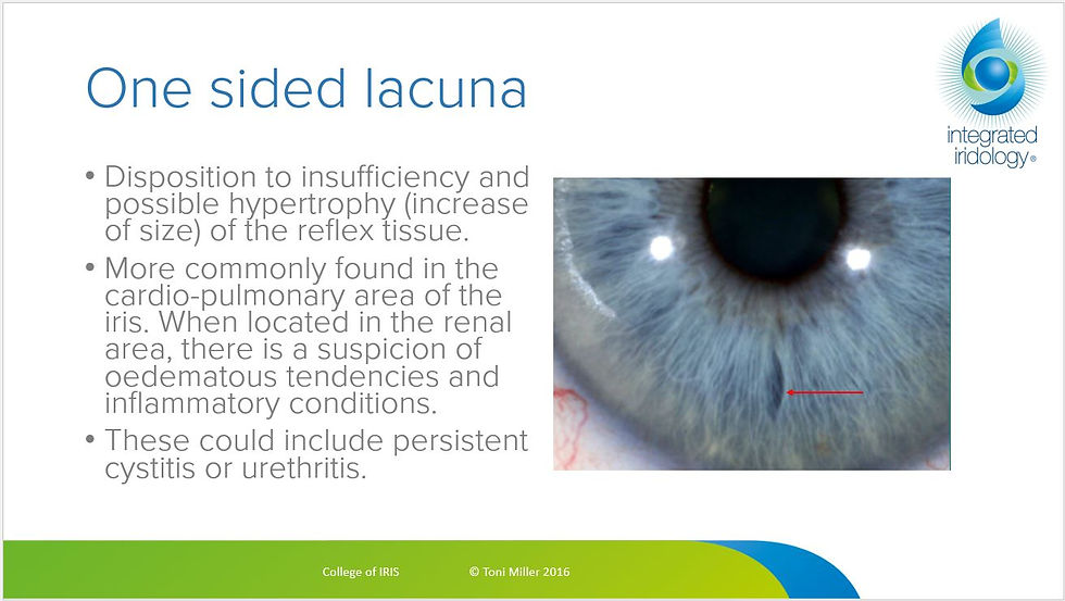 Thumbnail: Determining Potential Urinary Issues from the eye