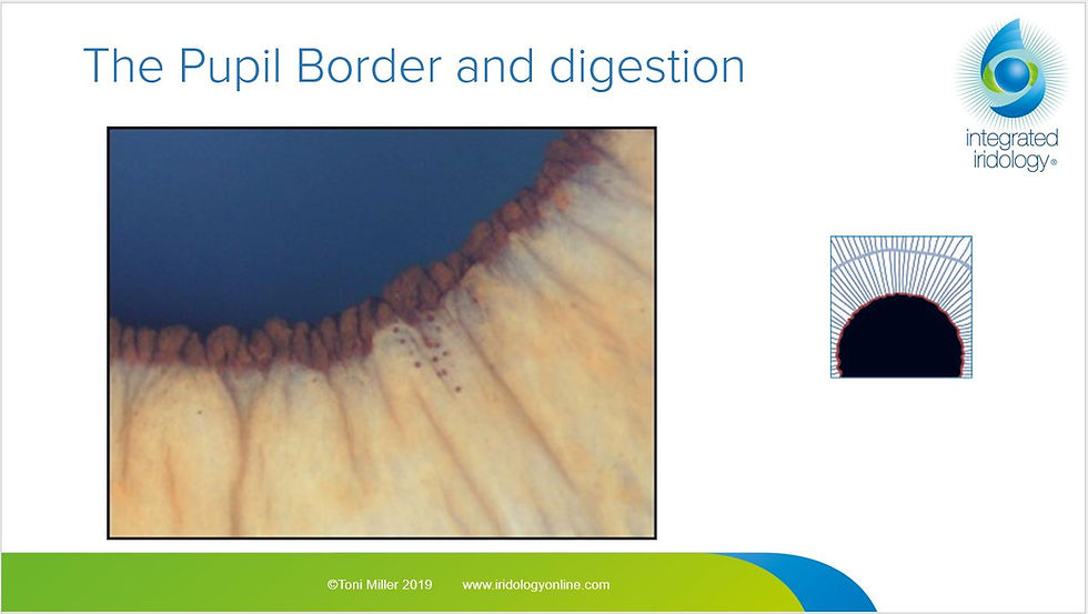 Thumbnail: Signs of Digestive Dysfunction