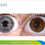 Thumbnail: Iridology through the eyes of children