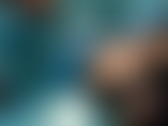 Experience D’Lux Hub's Expert Hair Transplant Services