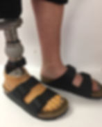 Prosthetic Limb requires backstrap