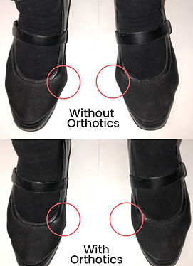 Without Orthotics.jpg