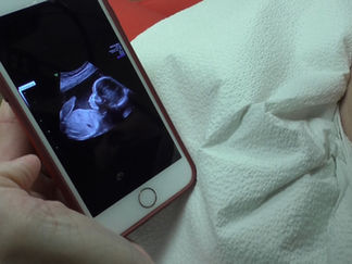 New Technology Makes Ultrasound Images Available on Phones, Tablets