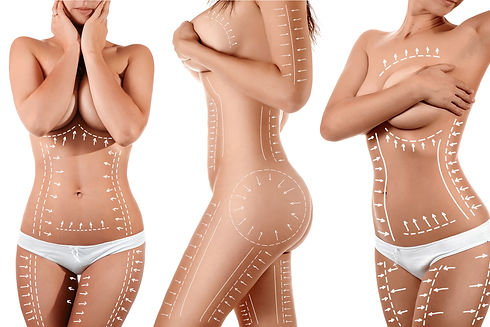 Liposuction Antalya Liposakşın