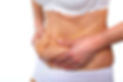 mini tummy tuck turkey antalya
