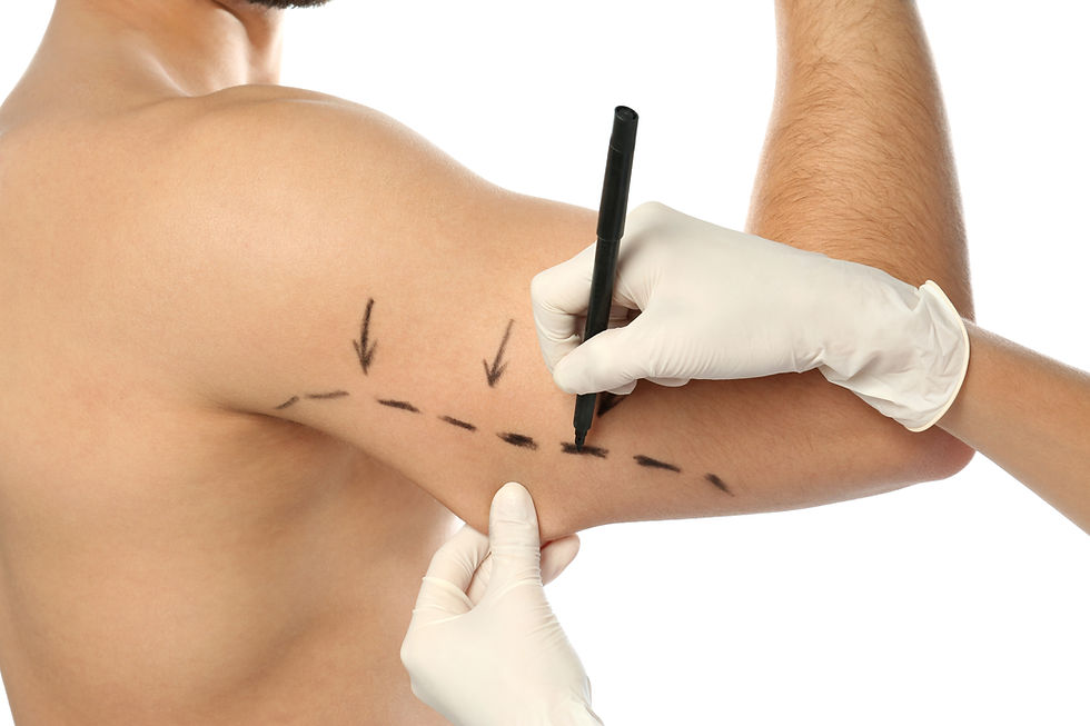 ARM LIFT SURGERY TURKEY ANTALYA