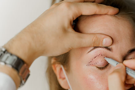 Blepharoplasty the plastic surgery opera