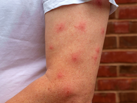 Menos Picadas, Mais Verão