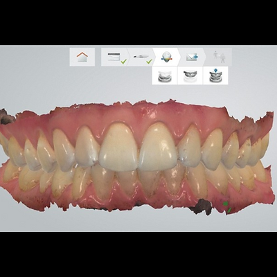Advanced Dental Care by MDS Specialist at DENTALK® Speciality Dental Clinic Pimple Saudagar