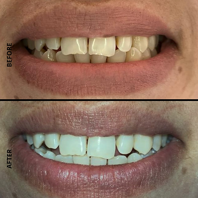 Advanced Dental Care by MDS Specialist at DENTALK® Speciality Dental Clinic Pimple Saudagar