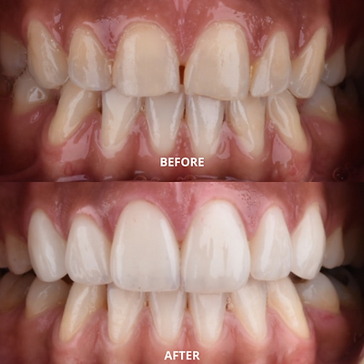 Advanced Dental Care by MDS Specialist at DENTALK® Speciality Dental Clinic Pimple Saudagar