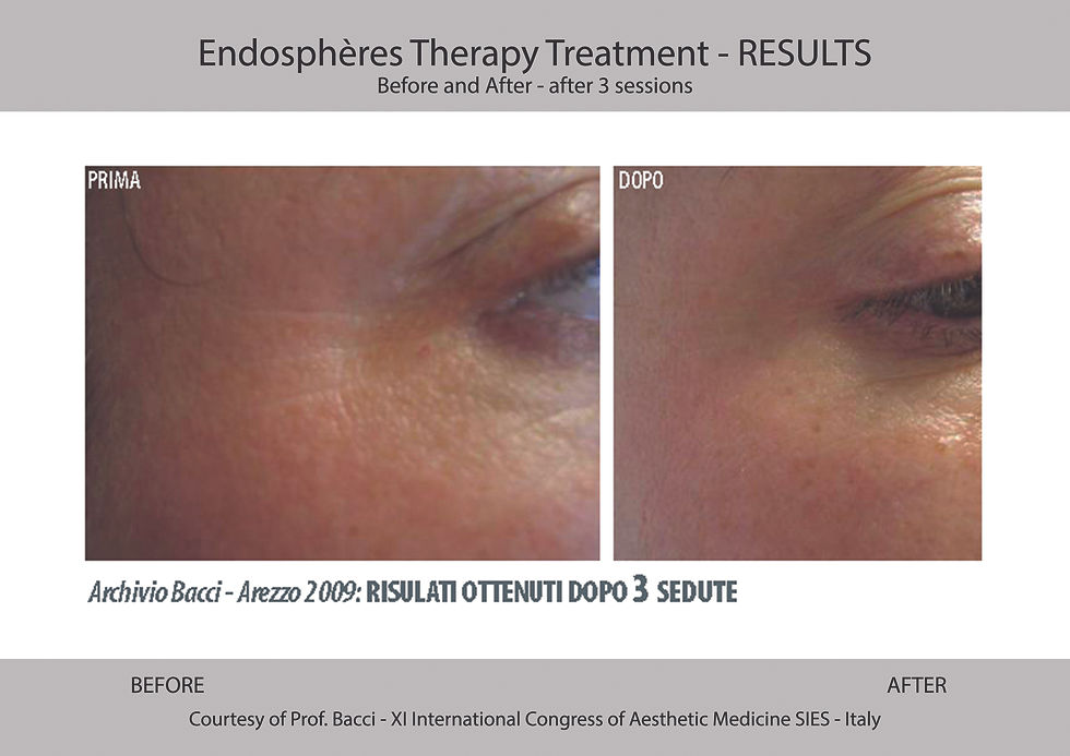 Before_After Face1