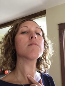 Papillary Thyroid Cancer