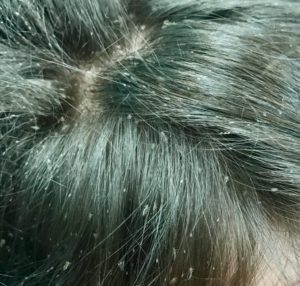 As long as you don’t look, it’s not there, right?