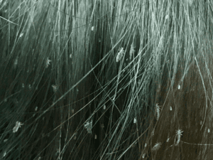 Missing just a male and female nit can help insure you find more new friends in a few weeks.