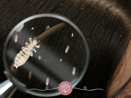 How to Get Head Lice and Keep It!